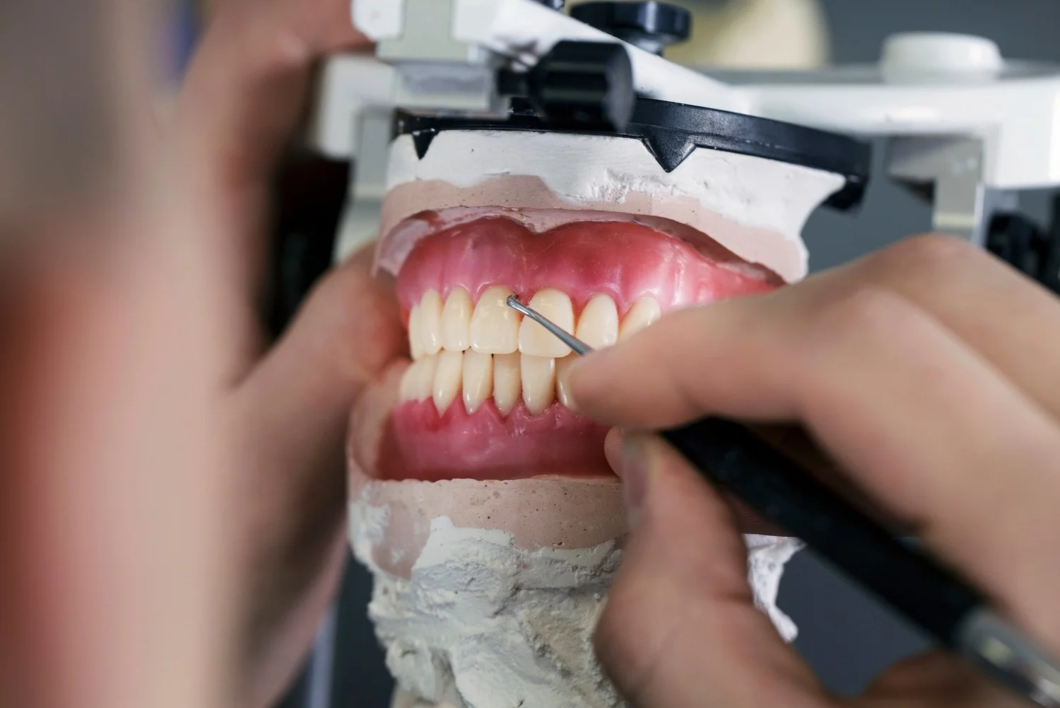 Dentures