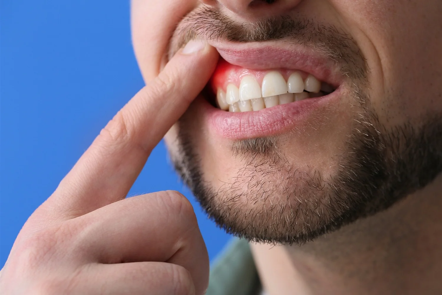 Gum Treatment