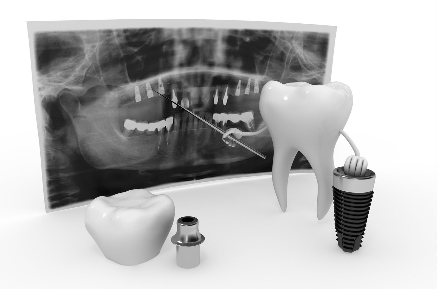 Dental Implants